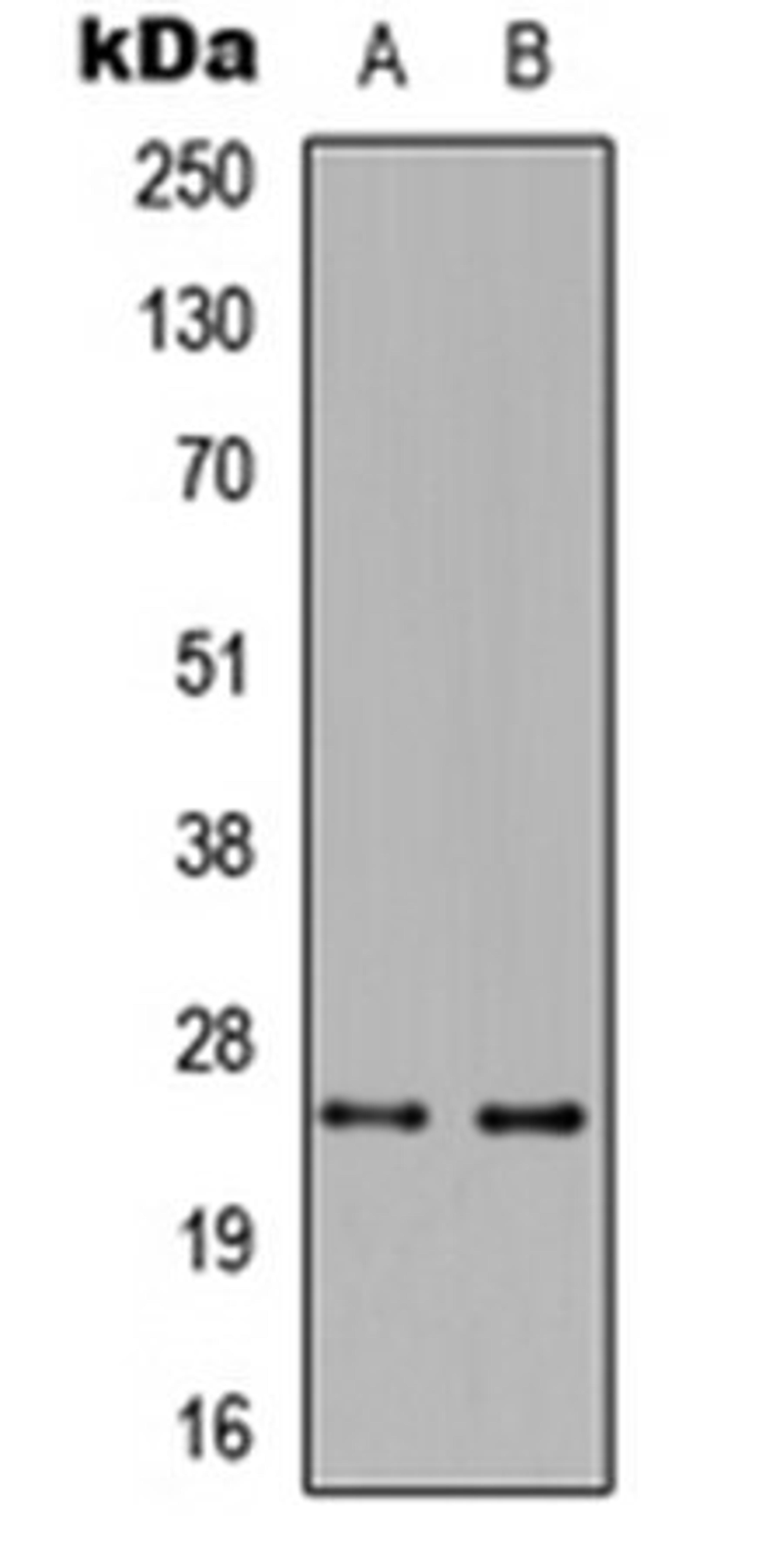 Western blot analysis of HeLa (Lane 1), Raw264.7 (Lane 2) whole cell lysates using CD258 antibody