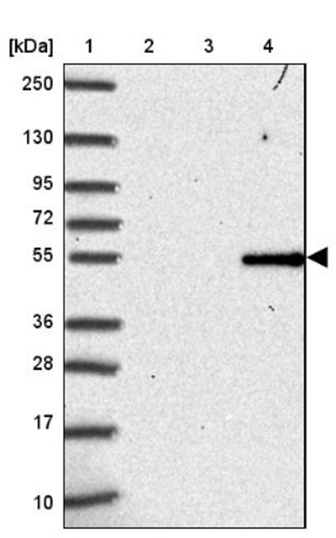 Western Blot: BBS1 Antibody [NBP2-34106] - Lane 1: Marker [kDa] 250, 130, 95, 72, 55, 36, 28, 17, 10<br/>Lane 2: Human cell line RT-4<br/>Lane 3: Human cell line U-251MG sp<br/>Lane 4: Human plasma (IgG/HSA depleted)