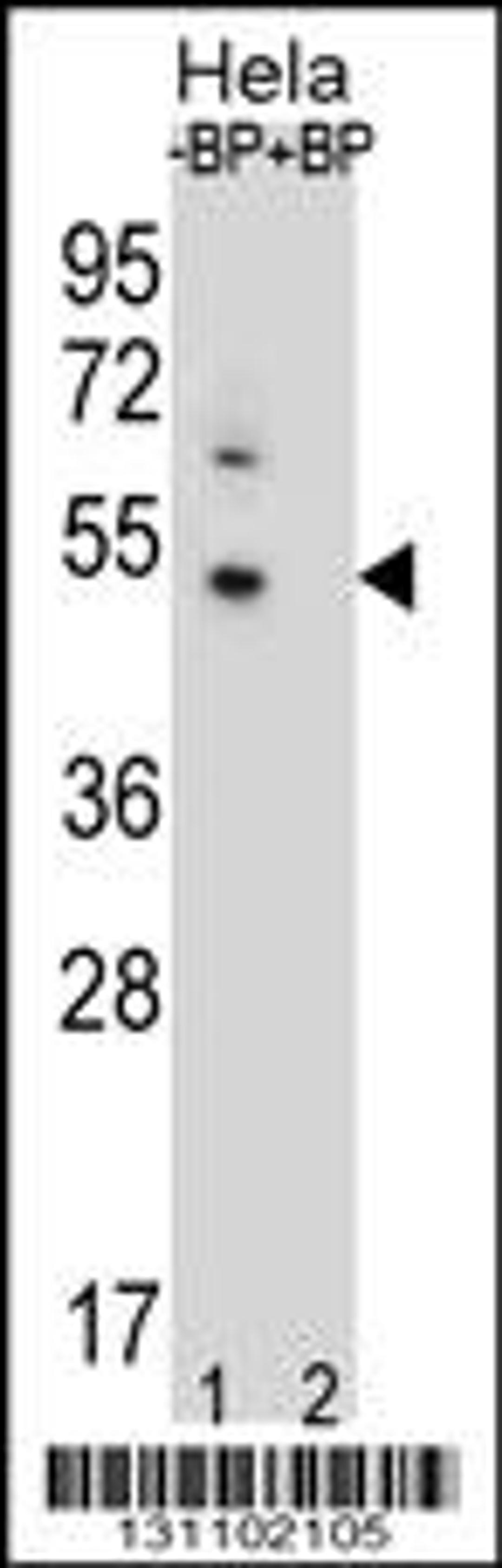 Western blot analysis of DNAJB6 Antibody Pab pre-incubated without(lane 1) and with(lane 2) blocking peptide in Hela cell line lysate.