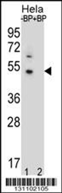 Western blot analysis of DNAJB6 Antibody Pab pre-incubated without(lane 1) and with(lane 2) blocking peptide in Hela cell line lysate.