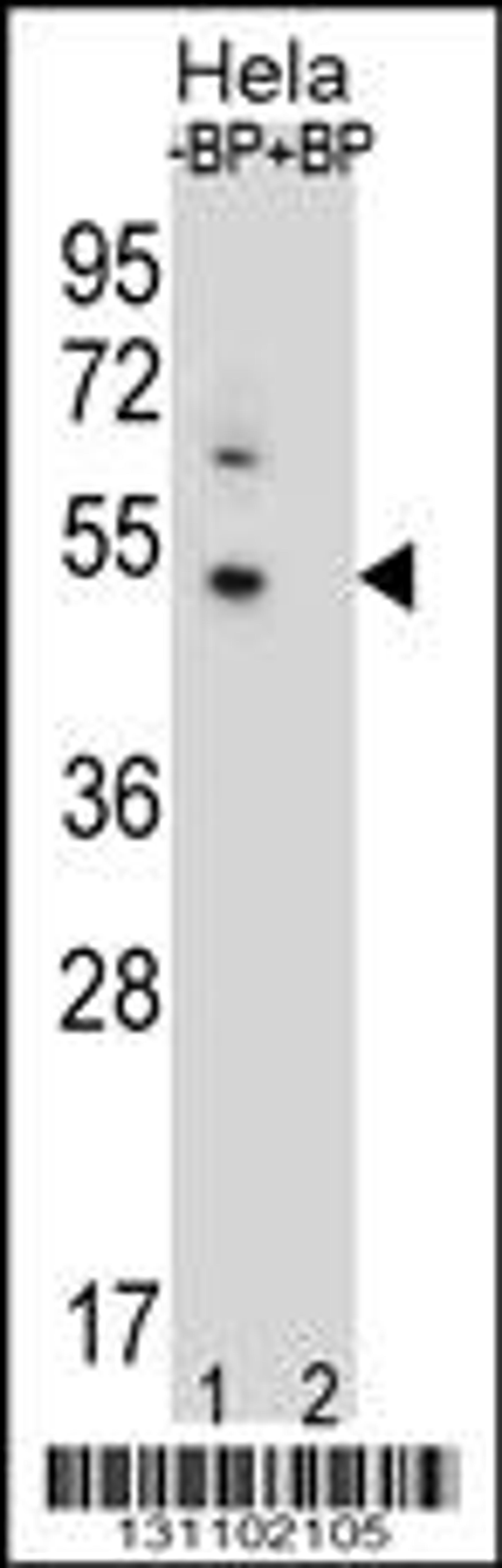 Western blot analysis of DNAJB6 Antibody Pab pre-incubated without(lane 1) and with(lane 2) blocking peptide in Hela cell line lysate.