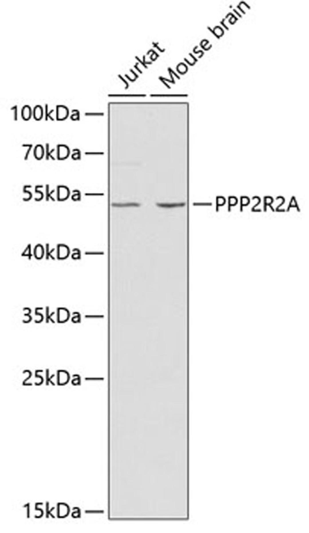 Western blot - PPP2R2A antibody (A2185)