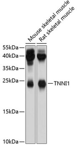 Western blot - TNNI1 antibody (A4161)