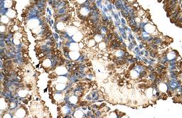 Antibody used in IHC on Human Intestine.