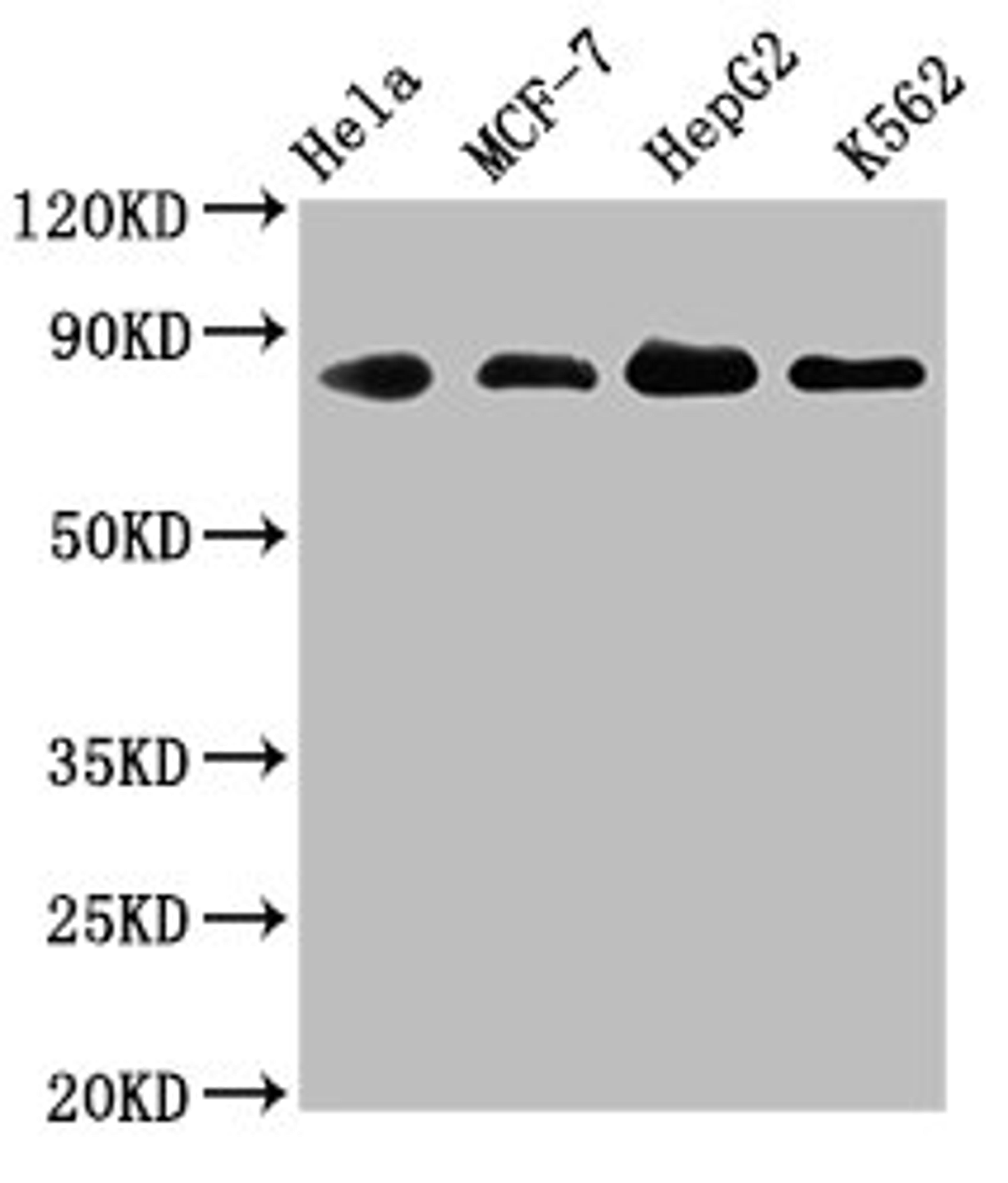 Western Blot. Positive WB detected in: Hela whole cell lysate, MCF-7 whole cell lysate, HepG2 whole cell lysate, K562 whole cell lysate. All lanes: ARNT antibody at 1.83μg/ml. Secondary. Goat polyclonal to rabbit IgG at 1/50000 dilution. Predicted band size: 87, 85, 86 KDa. Observed band size: 87 KDa. 