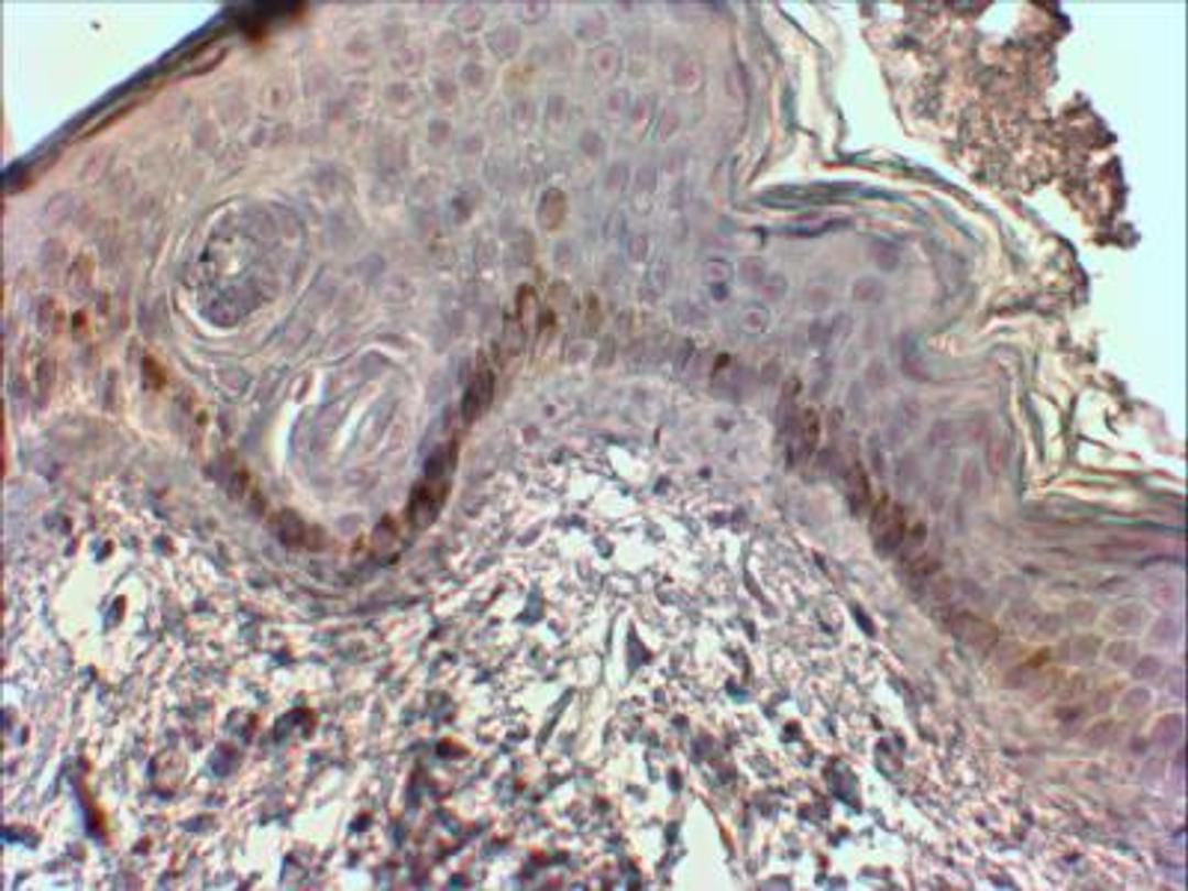 Immunohistochemistry-Paraffin: Chymase/CMA1/Mast Cell Chymase Antibody [NBP2-27551] - Staining of human skin Epidermis shows detection on the apical side of the basal cell layer.