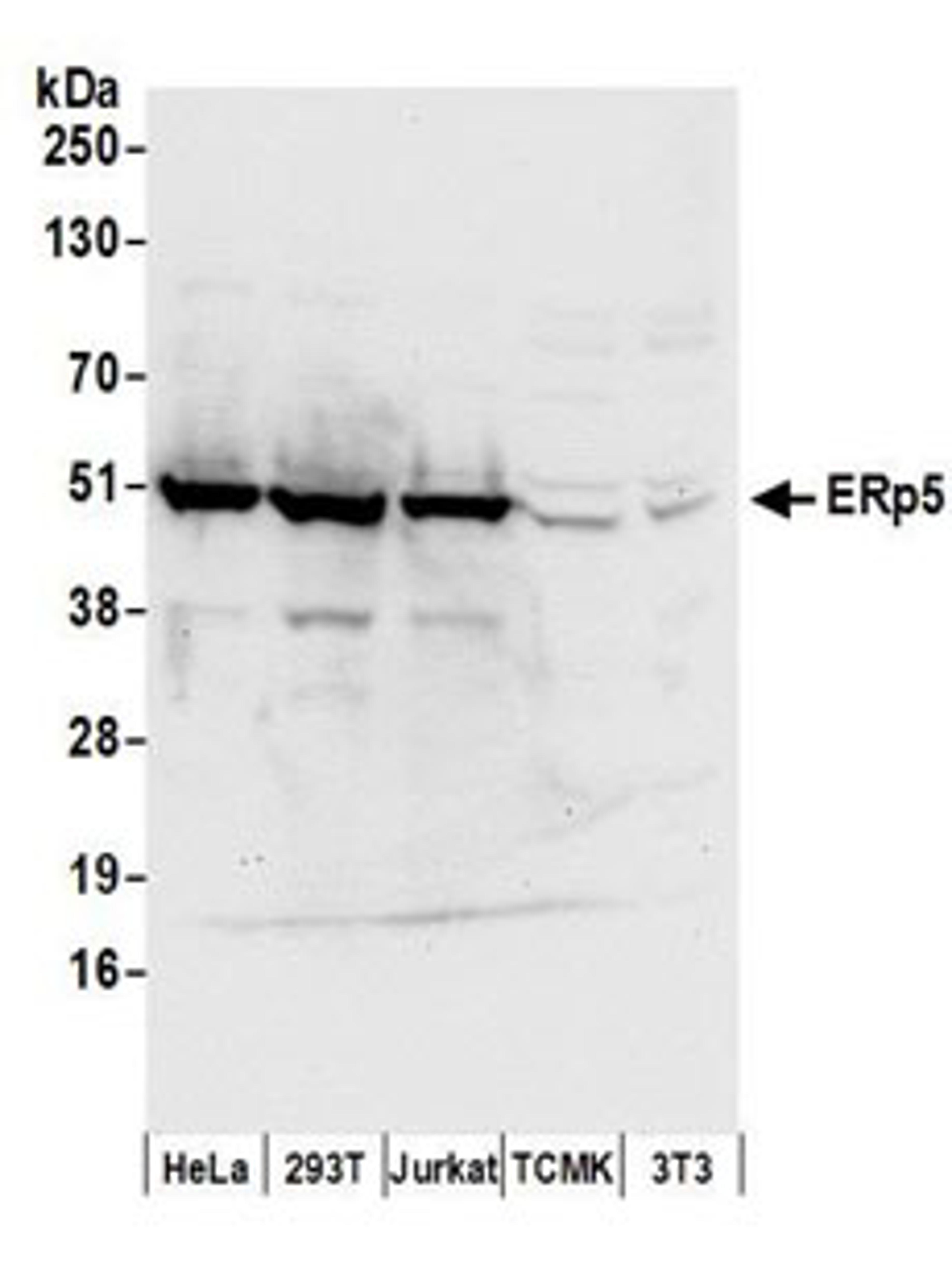 Detection of human ERp5 by western blot.