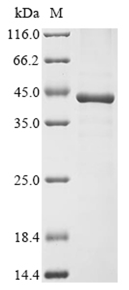 (Tris-Glycine gel) Discontinuous SDS-PAGE (reduced) with 5% enrichment gel and 15% separation gel.