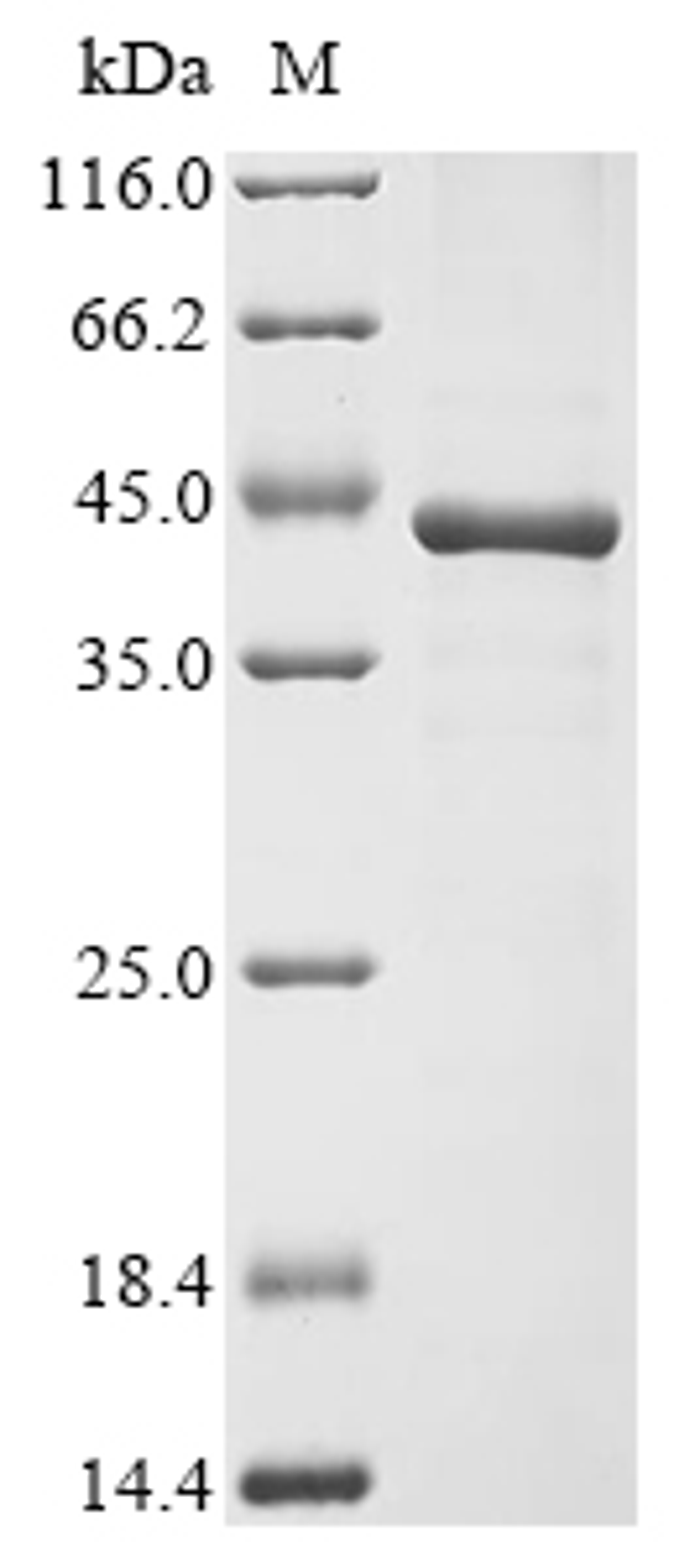 (Tris-Glycine gel) Discontinuous SDS-PAGE (reduced) with 5% enrichment gel and 15% separation gel.