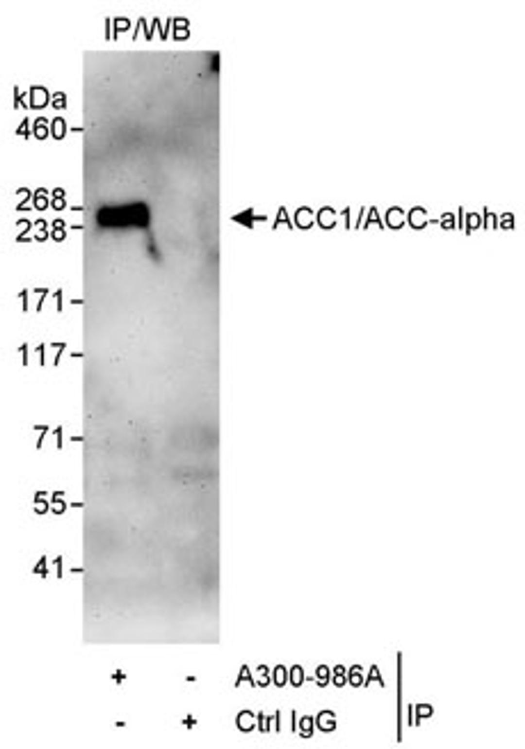 Detection of human ACC1/ACC-alpha by western blot of immunoprecipitates.