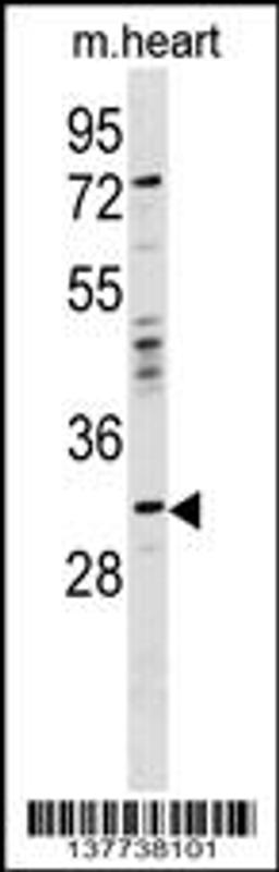 Western blot analysis in mouse heart tissue lysates (35ug/lane).