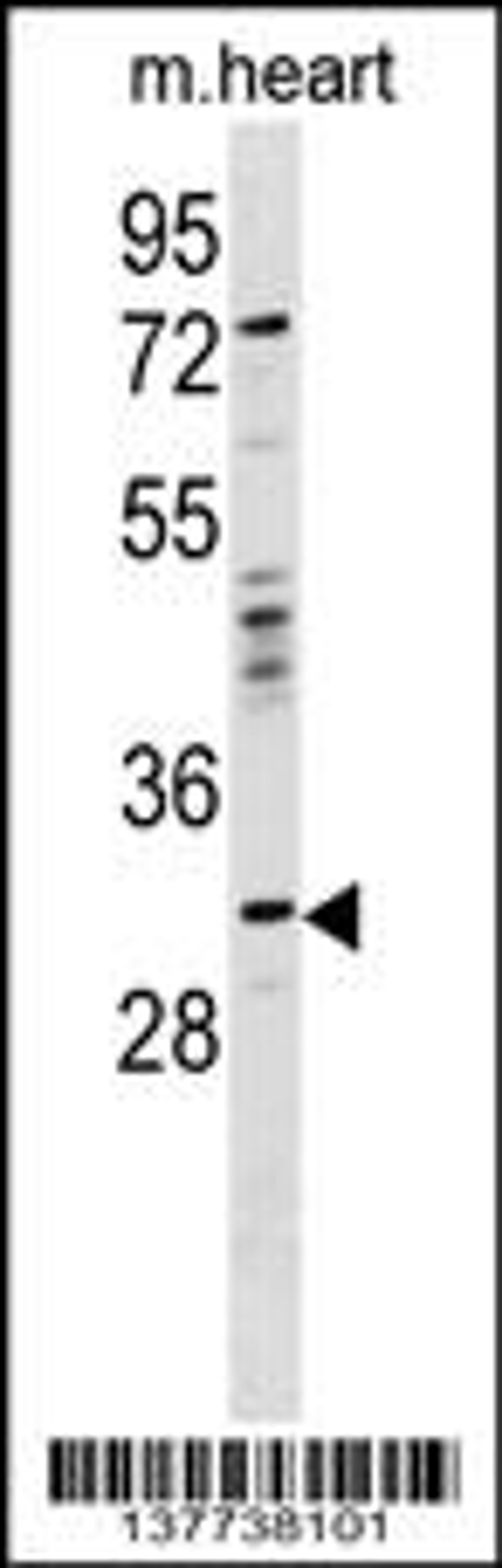 Western blot analysis in mouse heart tissue lysates (35ug/lane).