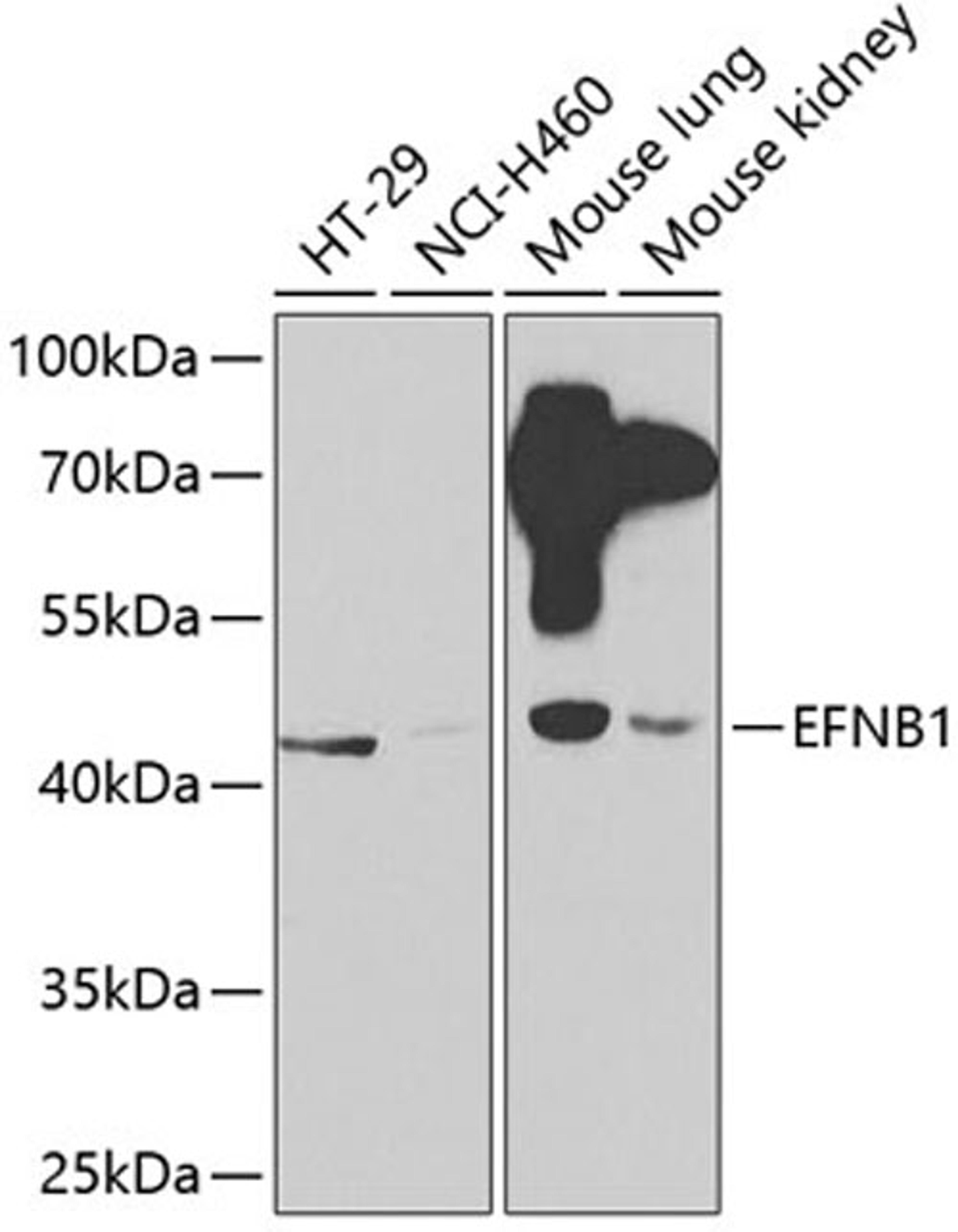 Western blot - EFNB1 antibody (A2518)