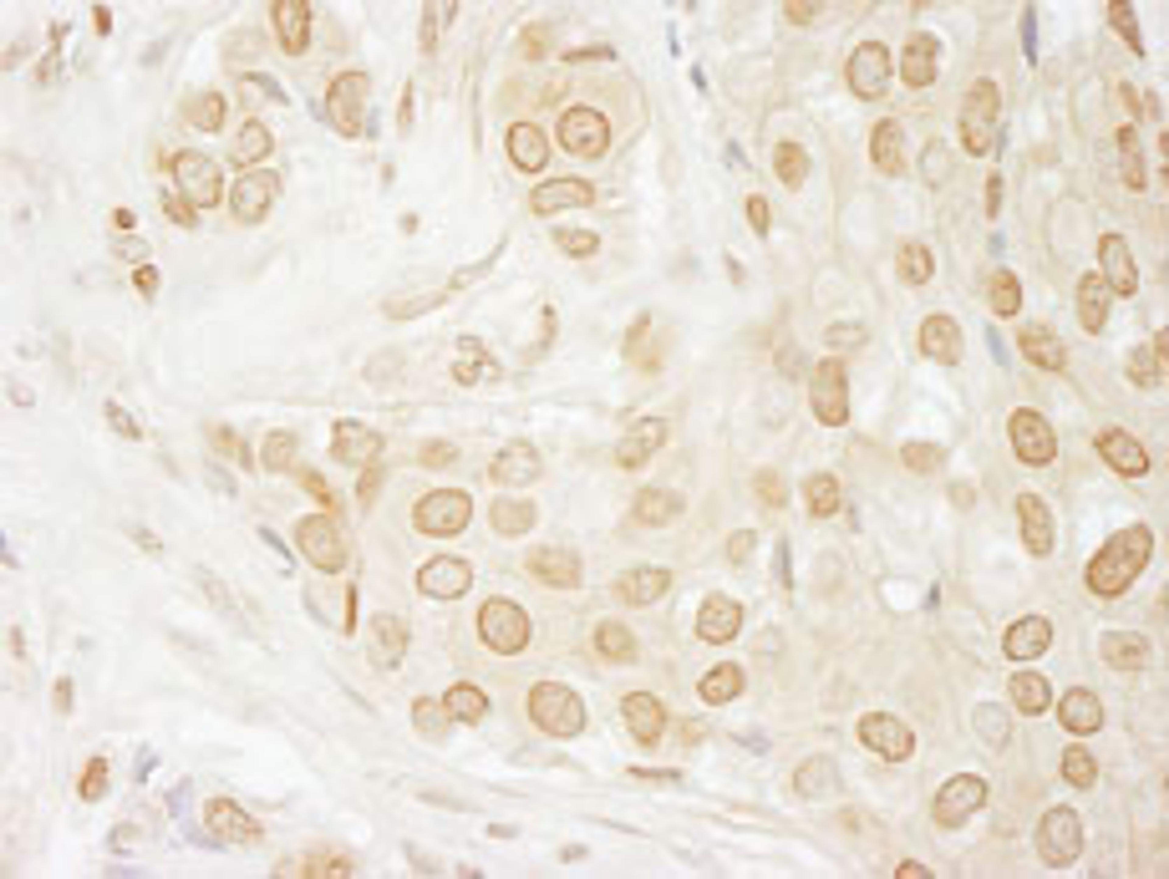 Detection of human USP33 by immunohistochemistry.