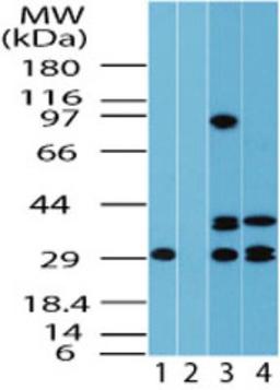 Western Blot: FUZ Antibody [NBP2-24750] - analysis of FUZ in human lung lysate in the 1) absence and 2) presence of immunizing peptide, 3) mouse lung and 4) rat lung using this antibody. 0 ug/ml, 2.0 ug/ml and 6.0 ug/ml respectively.