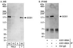 Detection of human SOS1 by western blot and immunoprecipitation.