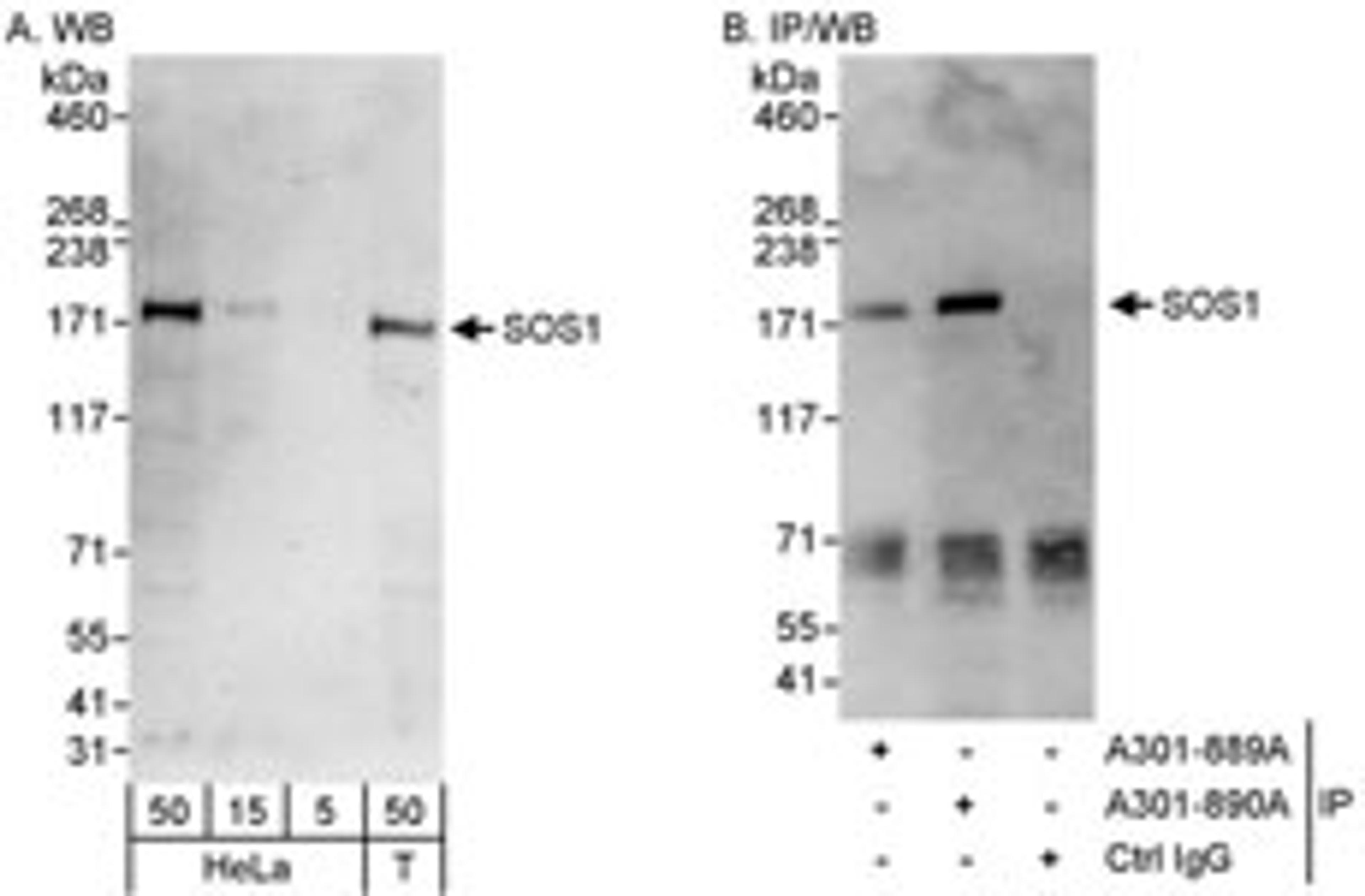 Detection of human SOS1 by western blot and immunoprecipitation.