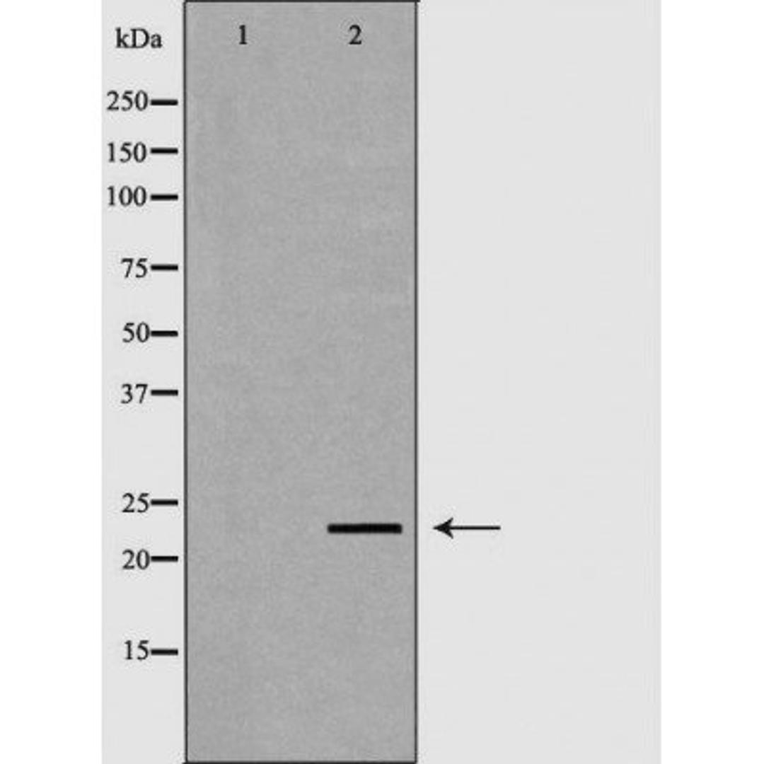 Western blot analysis of mouse livertissue lysate using NEUROG3 antibody