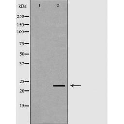 Western blot analysis of mouse livertissue lysate using NEUROG3 antibody