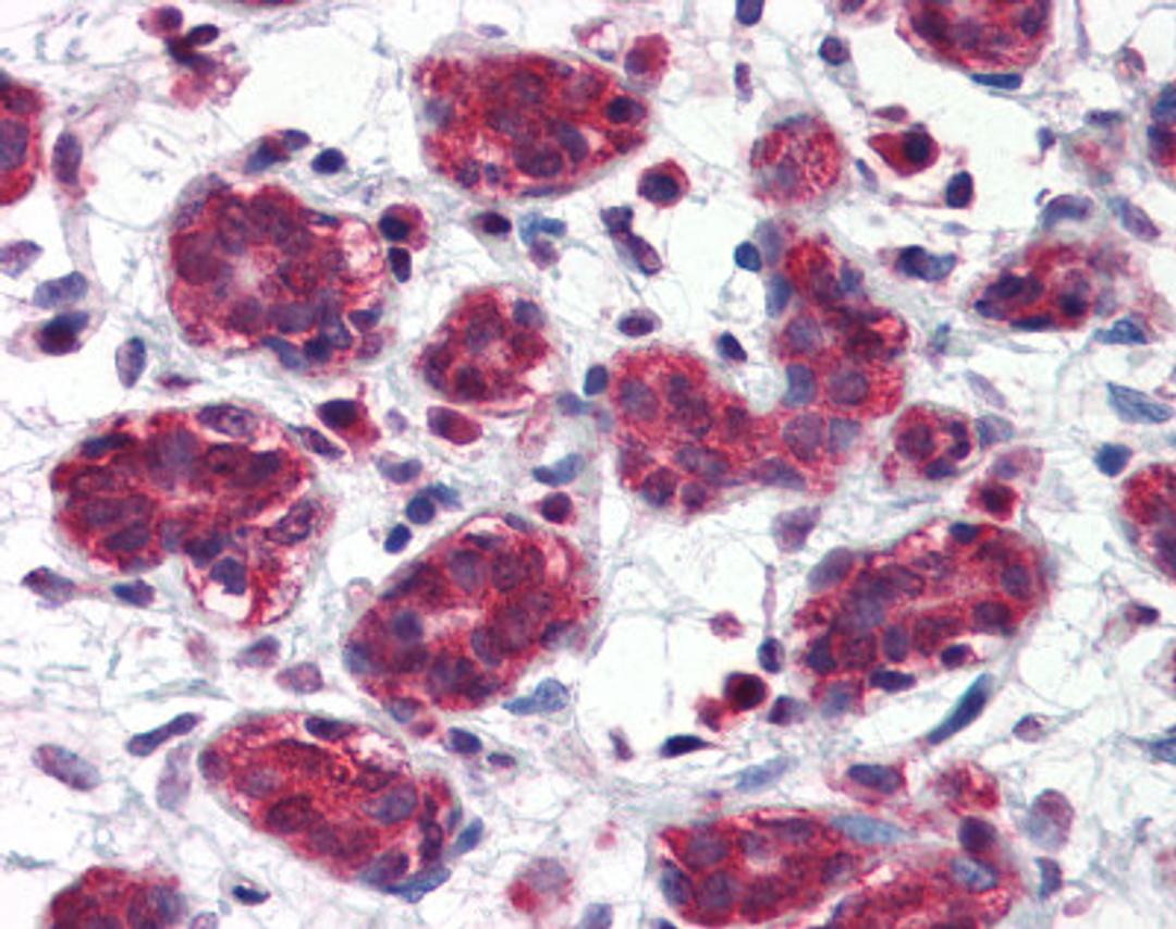 Human breast tissue stained with FOLH1 Antibody at 5 &#956;g/mL followed by biotinylated anti-mouse IgG secondary antibody, alkaline phosphatase-streptavidin and chromogen.