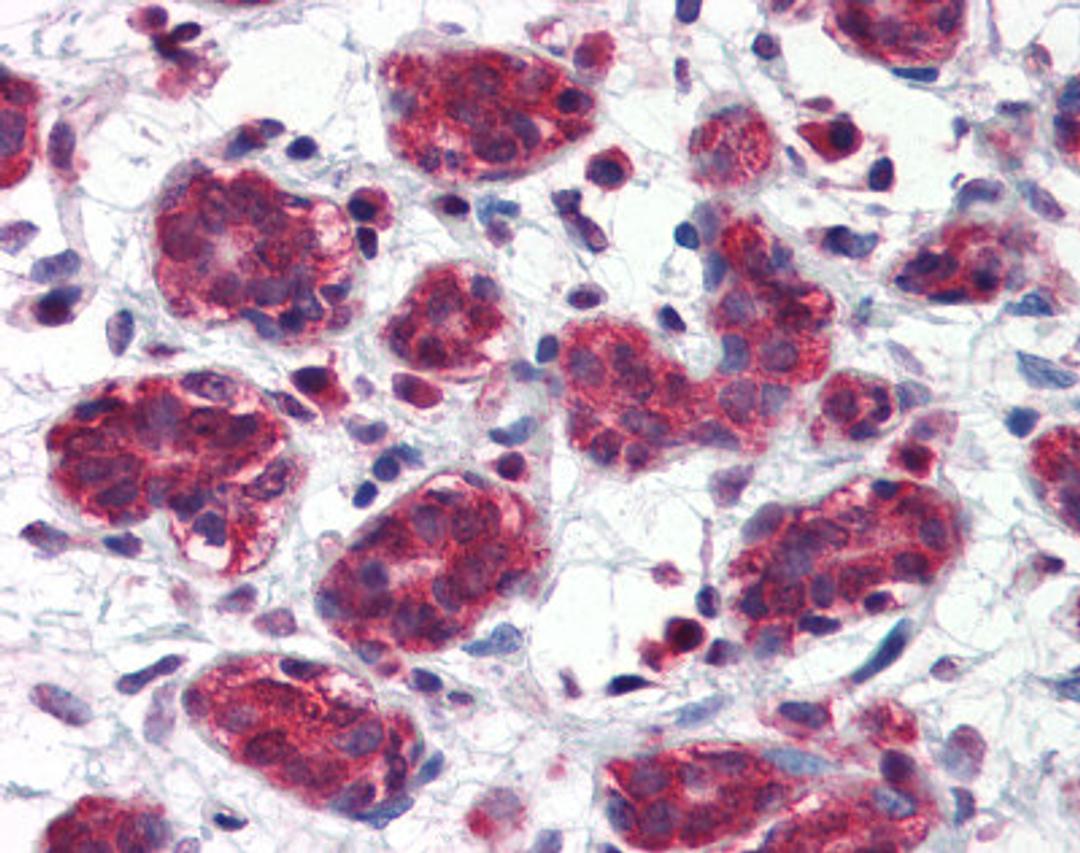 Human breast tissue stained with FOLH1 Antibody at 5 μg/mL followed by biotinylated anti-mouse IgG secondary antibody, alkaline phosphatase-streptavidin and chromogen.