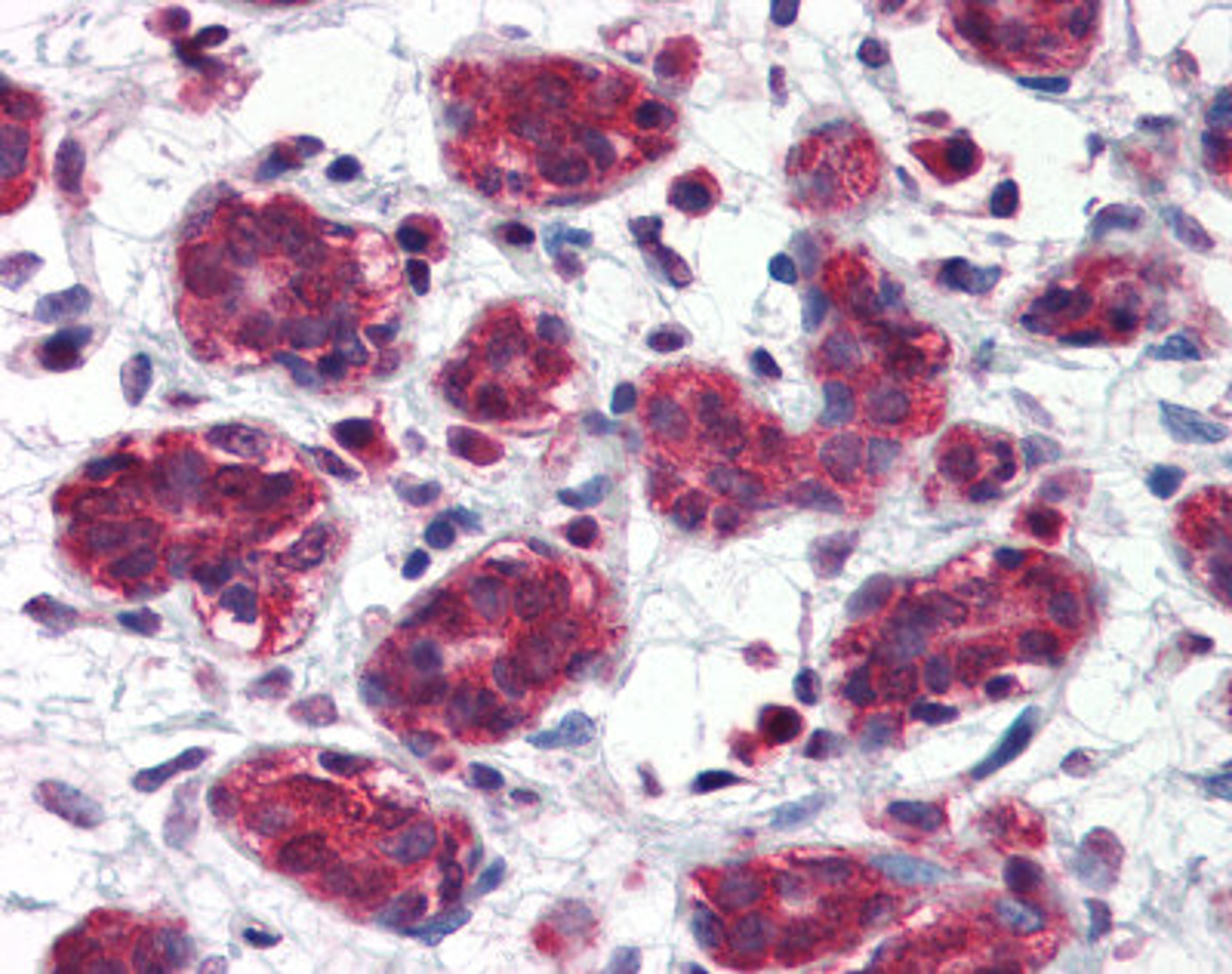 Human breast tissue stained with FOLH1 Antibody at 5 μg/mL followed by biotinylated anti-mouse IgG secondary antibody, alkaline phosphatase-streptavidin and chromogen.