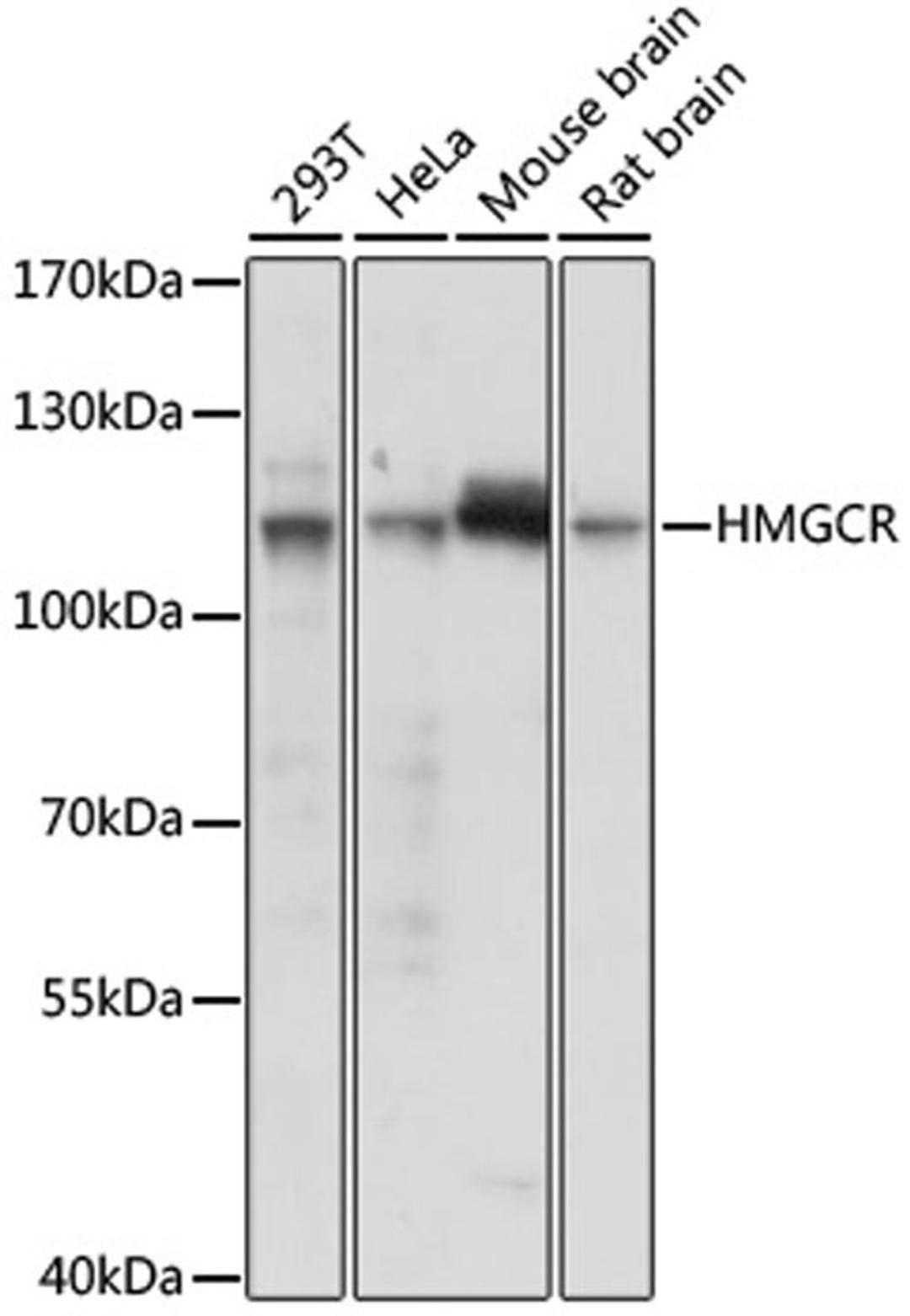 Western blot - HMGCR antibody (A16875)