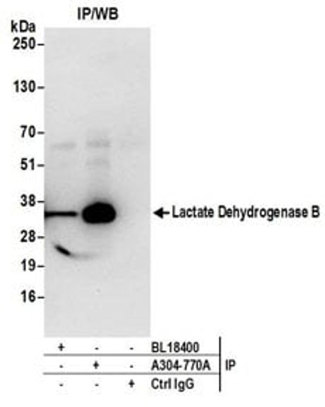 Detection of human Lactate Dehydrogenase B by western blot of immunoprecipitates.