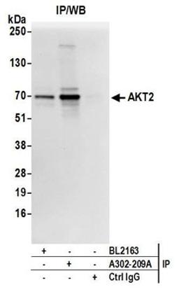 Detection of human AKT2 by western blot of immunoprecipitates.