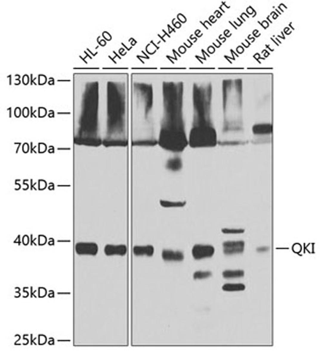 Western blot - QKI antibody (A7043)