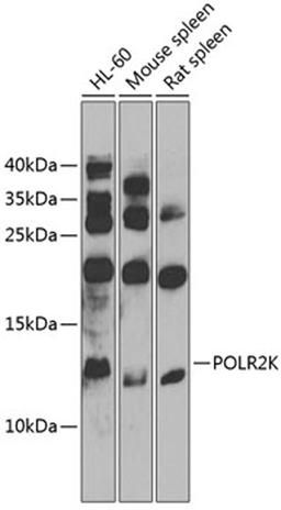 Western blot - POLR2K antibody (A9836)