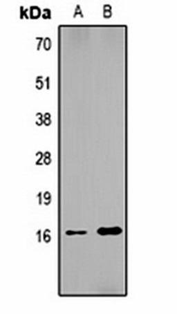 Western blot analysis of  Hela (Lane1), NIH3T3 (Lane2) whole cell lysates using Histone H1 (DiMethyl K25) antibody