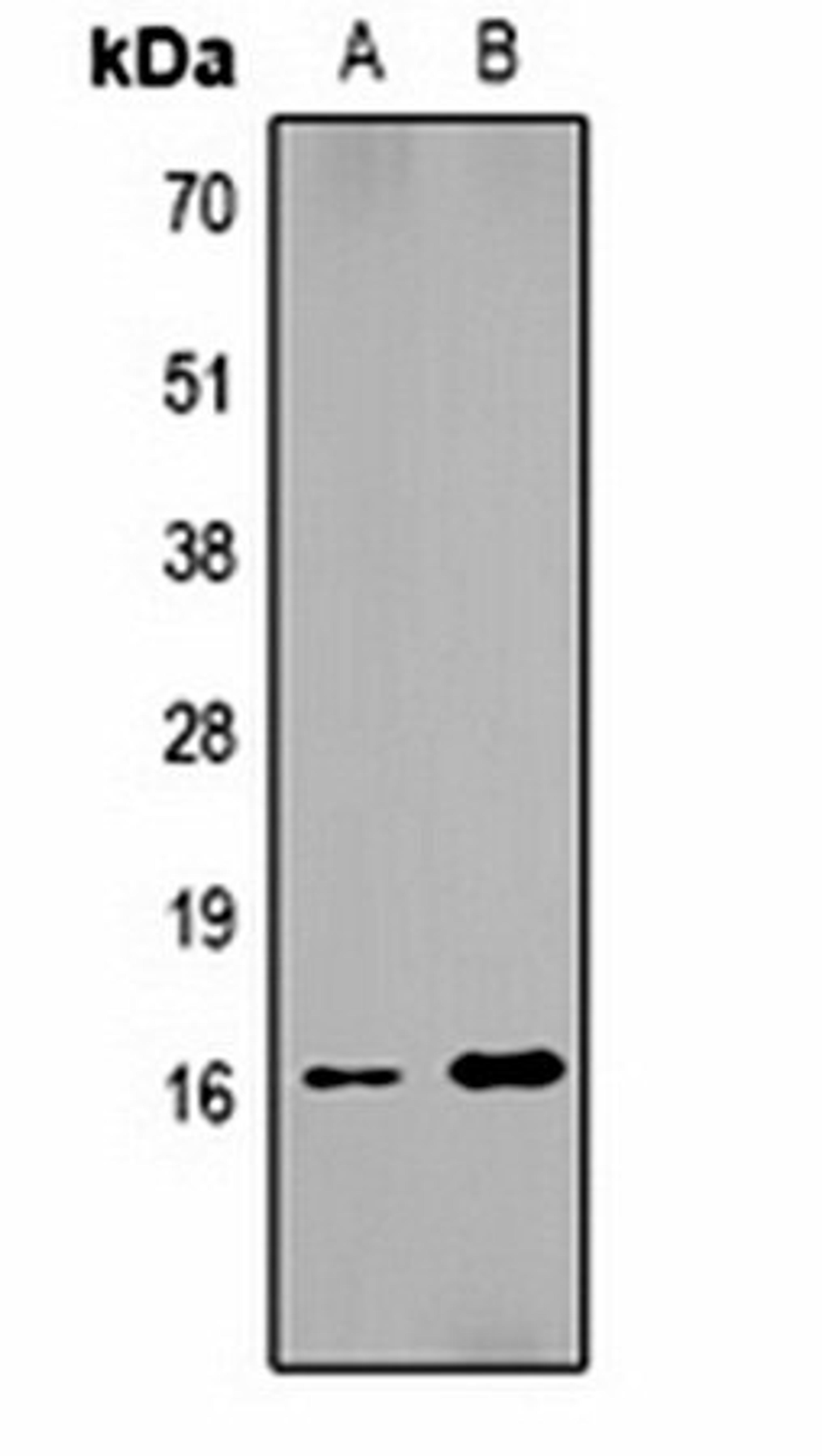 Western blot analysis of  Hela (Lane1), NIH3T3 (Lane2) whole cell lysates using Histone H1 (DiMethyl K25) antibody