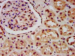 IHC image of CSB-PA010429OA16ncrHU diluted at 1:5 and staining in paraffin-embedded human kidney tissue performed on a Leica BondTM system. After dewaxing and hydration, antigen retrieval was mediated by high pressure in a citrate buffer (pH 6.0). Section was blocked with 10% normal goat serum 30min at RT. Then primary antibody (1% BSA) was incubated at 4&deg;C overnight. The primary is detected by a biotinylated secondary antibody and visualized using an HRP conjugated SP system.
