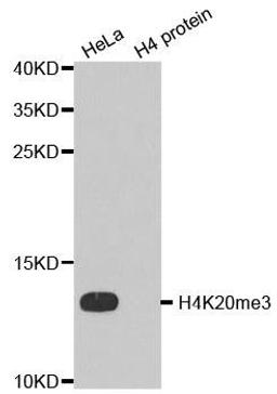 Western blot analysis of extracts of HeLa cell line and H4 protein expressed in E.coli using HIST2H4A antibody