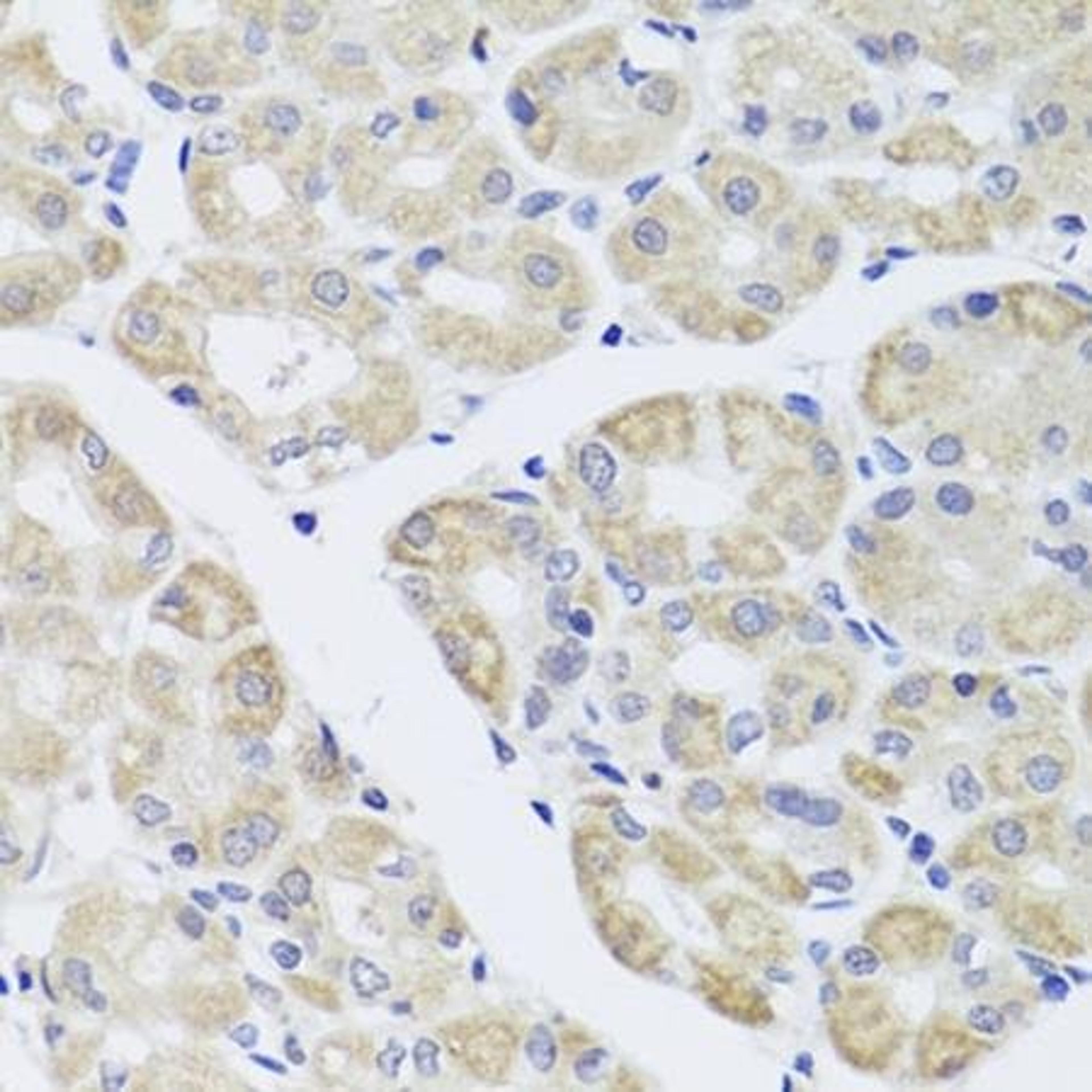 Immunohistochemical staining of human stomach tissue using DISC1 antibody