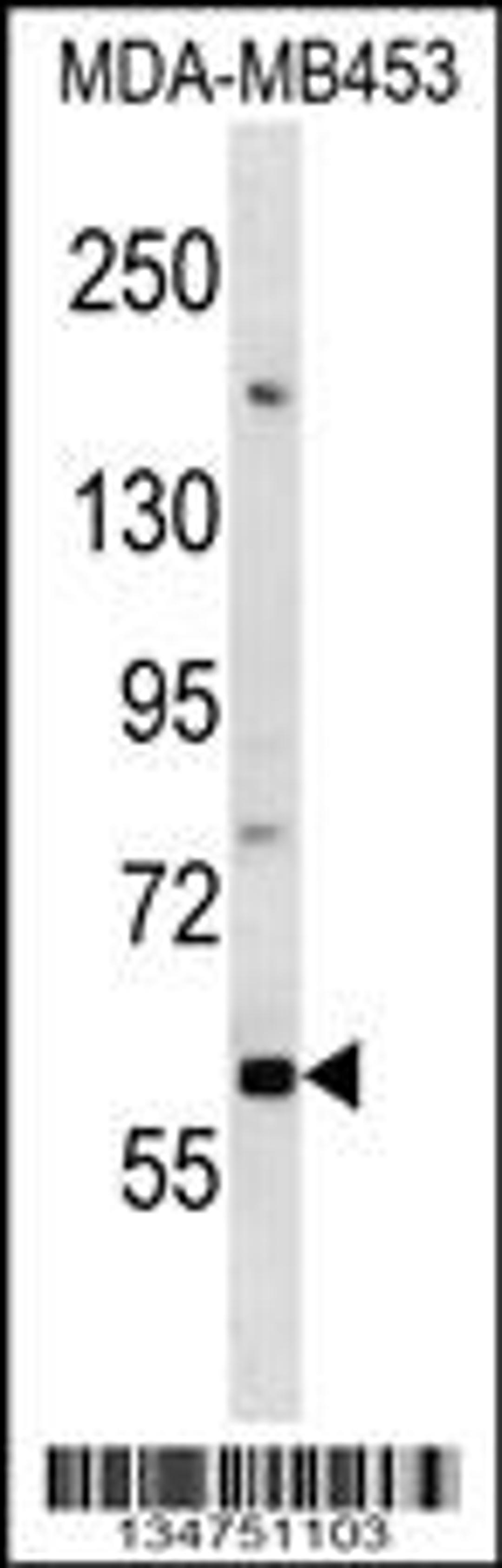 Western blot analysis in MDA-MB453 cell line lysates (35ug/lane).