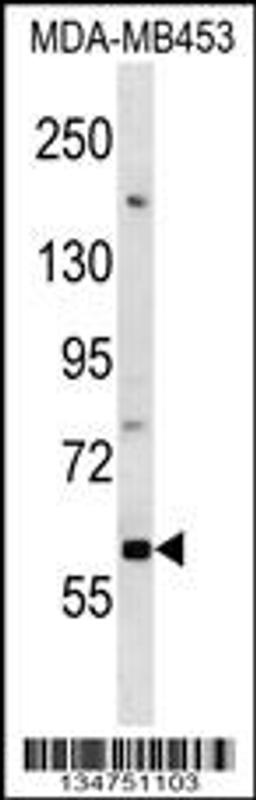 Western blot analysis in MDA-MB453 cell line lysates (35ug/lane).