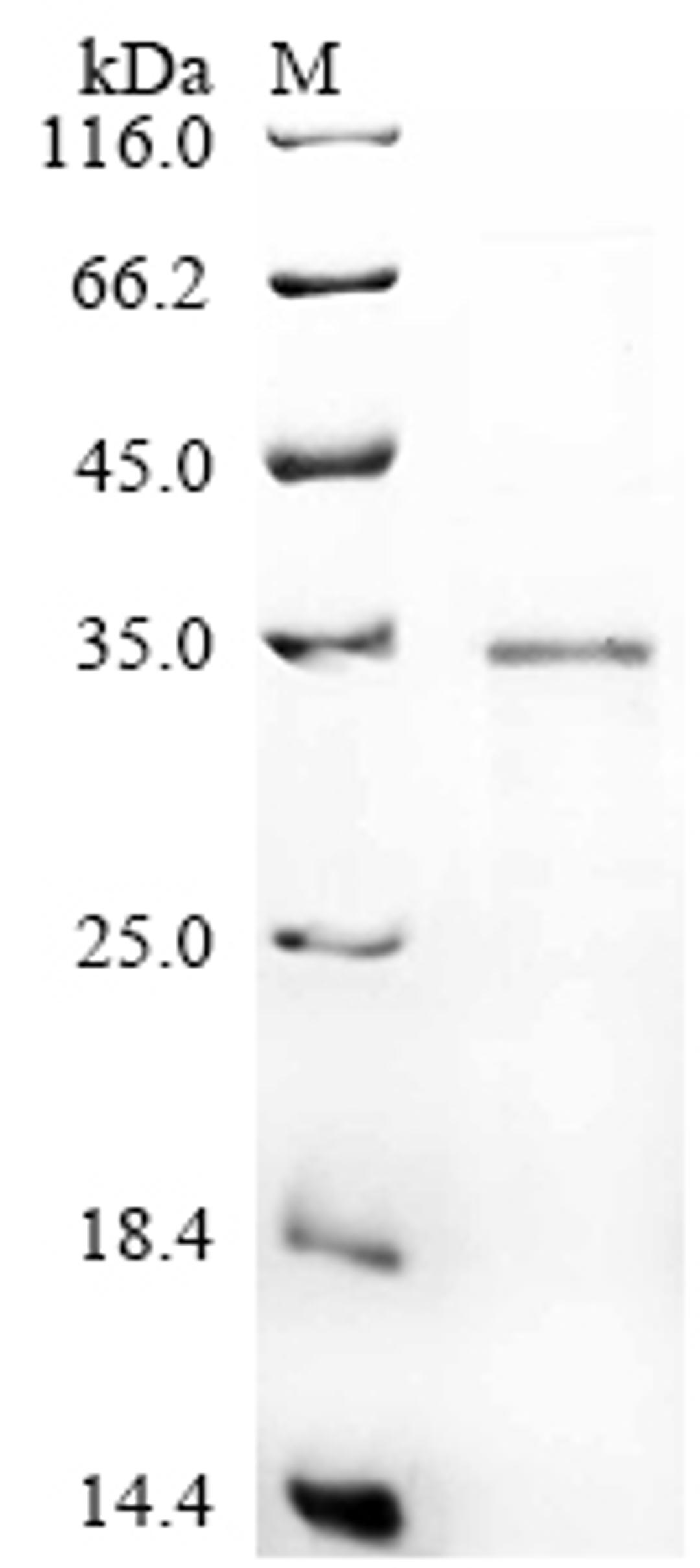 (Tris-Glycine gel) Discontinuous SDS-PAGE (reduced) with 5% enrichment gel and 15% separation gel.