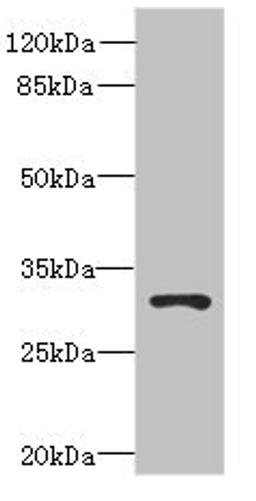 Western blot. All lanes: UNC50 antibody at 0.2µg/ml + 293T whole cell lysate. Secondary. Goat polyclonal to rabbit IgG at 1/10000 dilution. Predicted band size: 31 kDa. Observed band size: 31 kDa