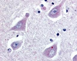 Immunohistochemistry-Paraffin: GPER/GPR30 Antibody [NLS4271] - Analysis of anti-GPR30 antibody with human brain, hippocampus.