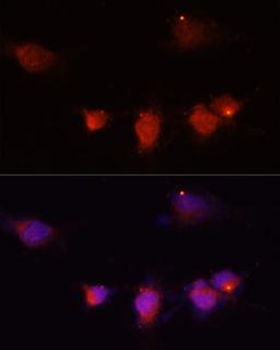 Immunofluorescence - NPY antibody (A15076)