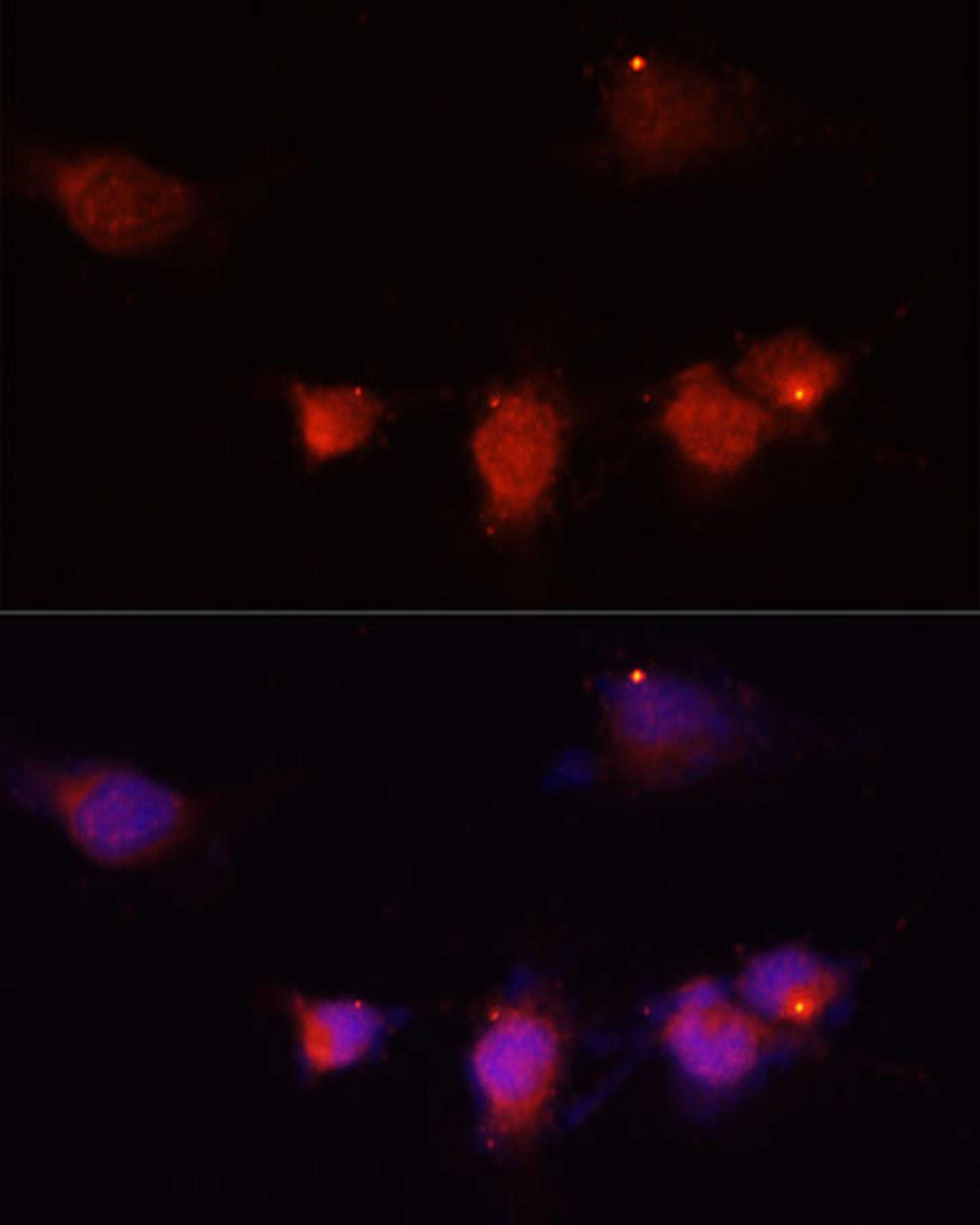 Immunofluorescence - NPY antibody (A15076)