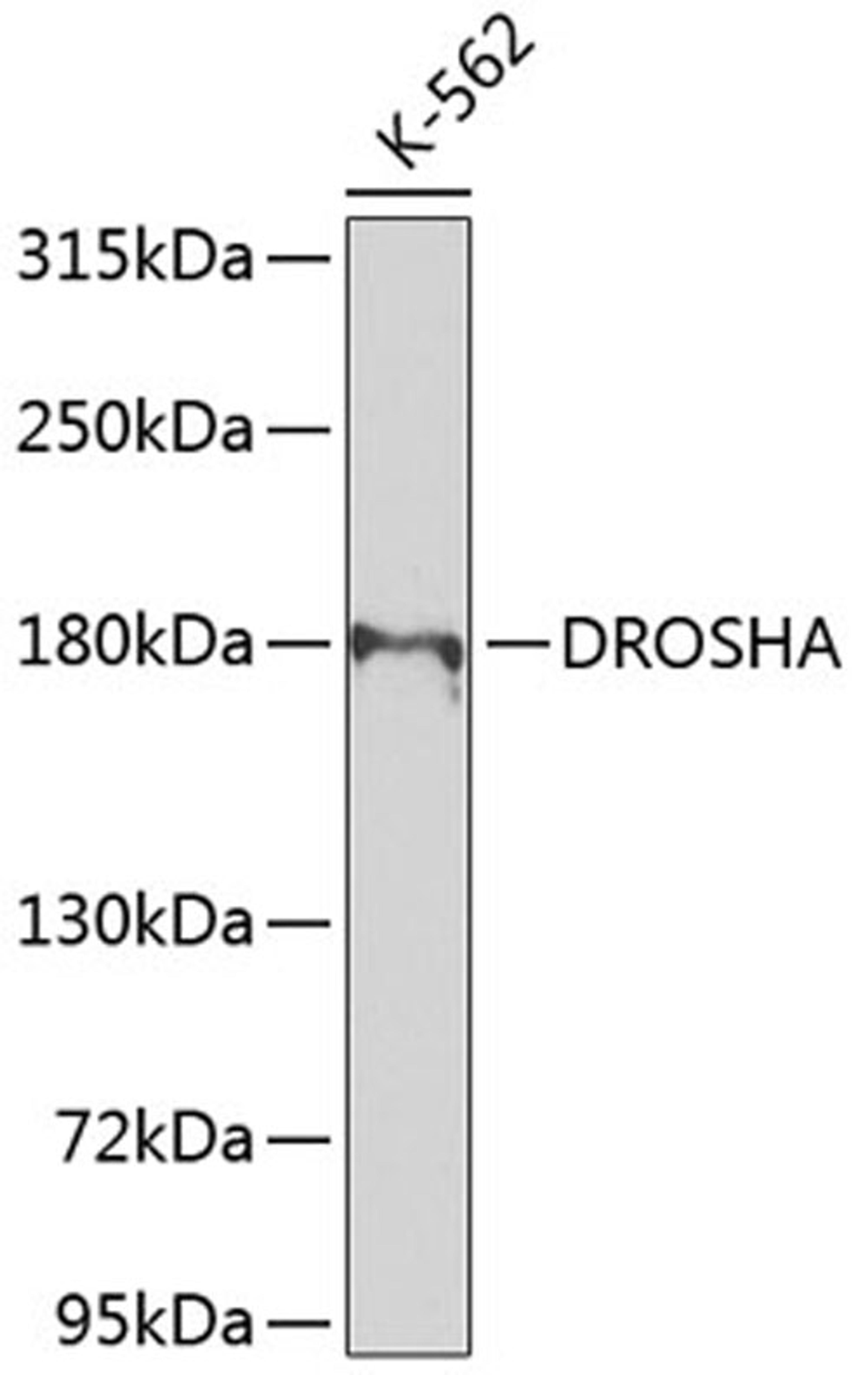 Western blot - DROSHA antibody (A8336)