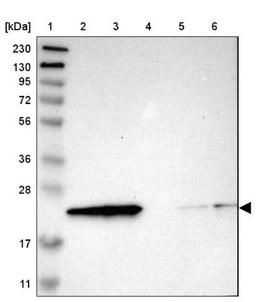 Western Blot: RBM8A Antibody [NBP1-88376] - Lane 1: Marker [kDa] 230, 130, 95, 72, 56, 36, 28, 17, 11<br/>Lane 2: Human cell line RT-4<br/>Lane 3: Human cell line U-251MG sp<br/>Lane 4: Human plasma (IgG/HSA depleted)<br/>Lane 5: Human liver tissue<br/>Lane 6: Human tonsil tissue