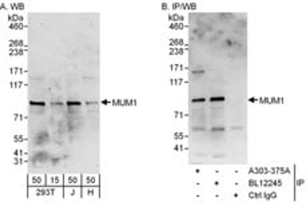 Detection of human MUM1 by western blot and immunoprecipitation.