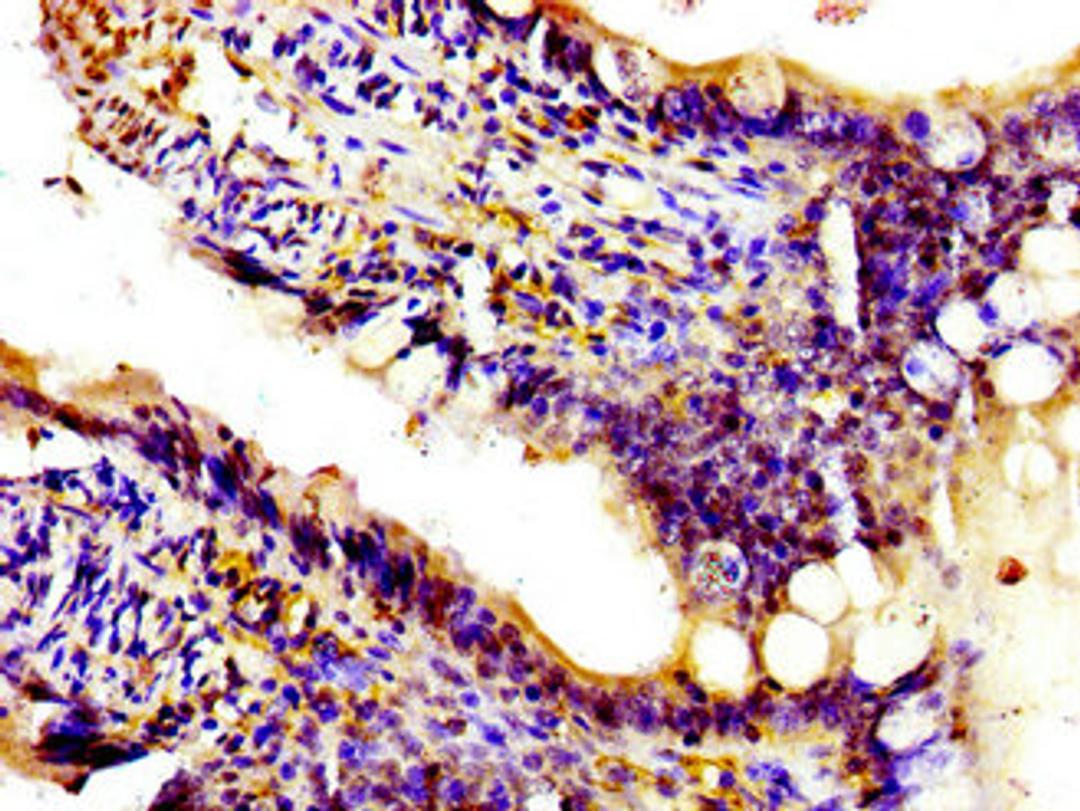 Immunohistochemistry of paraffin-embedded human small intestine tissue using CSB-PA017998LA01HU at dilution of 1:100
