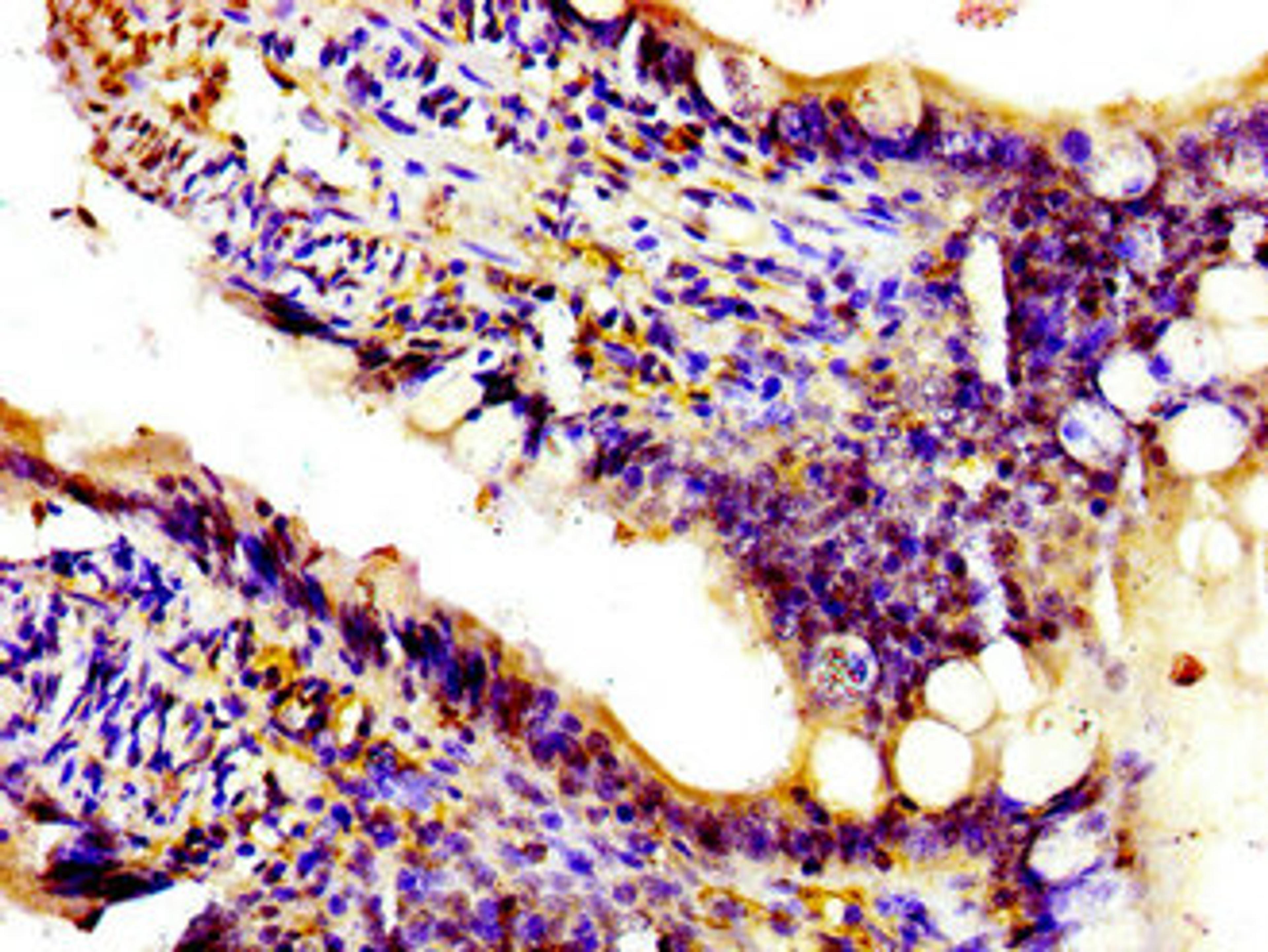 Immunohistochemistry of paraffin-embedded human small intestine tissue using CSB-PA017998LA01HU at dilution of 1:100