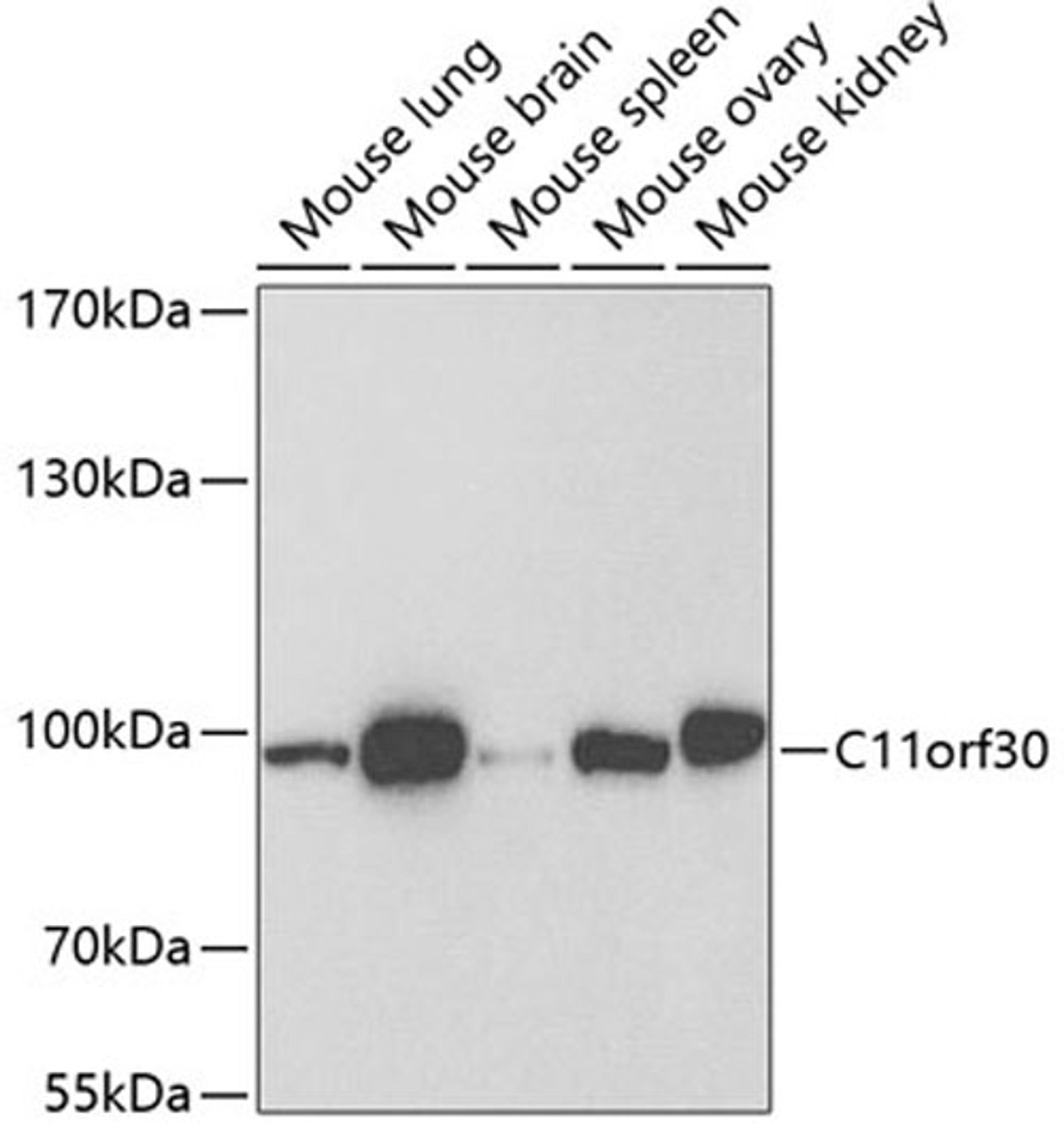 Western blot - C11orf30 antibody (A6138)