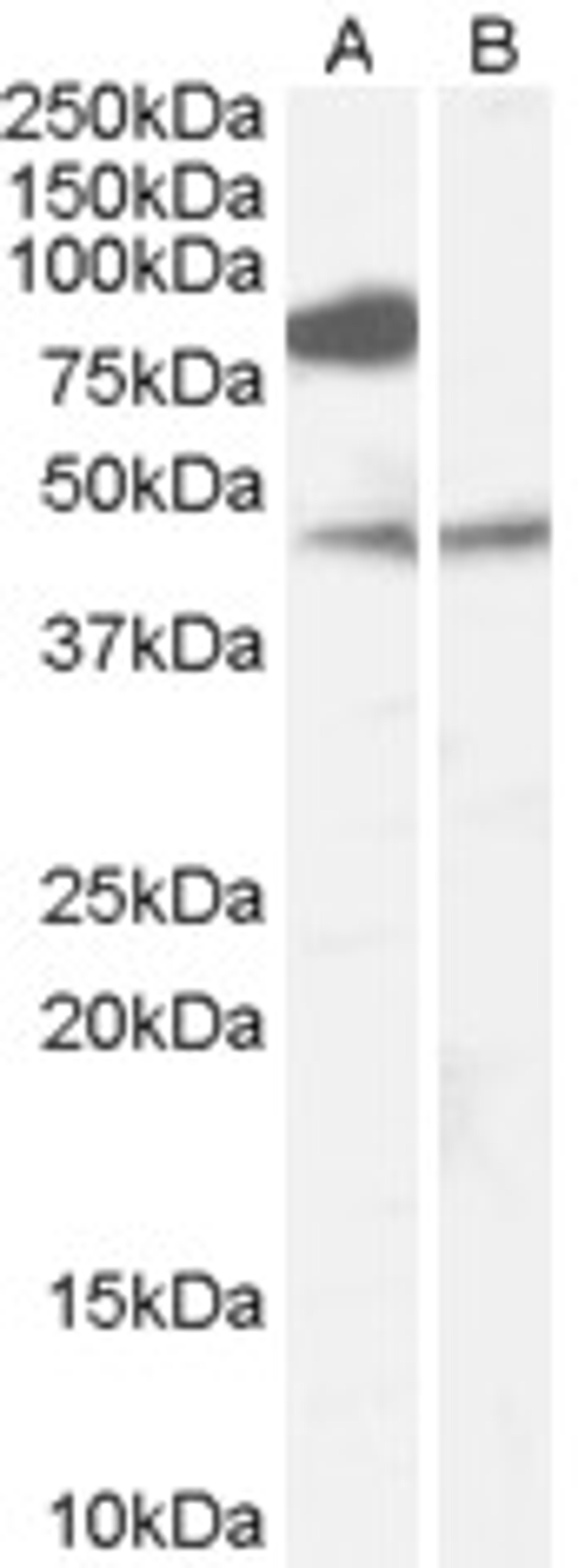 46-611 (0.1ug/ml) staining of Human Brain (Frontal Cortex) lysate (35ug protein in RIPA buffer) with (B) and without (A) blocking with the immunising peptide. Primary incubation was 1 hour. Detected by chemiluminescence.